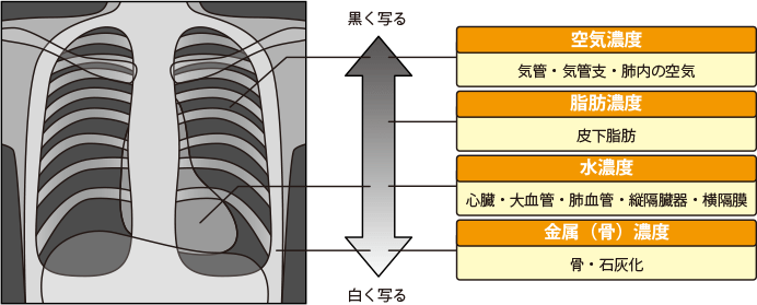 肺がんのレントゲン X線 検査 肺がん検査のさまざまな方法 肺がんとともに生きる